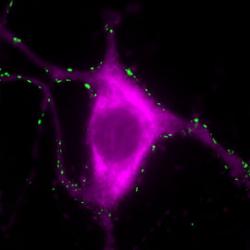 Tyrosine hydroxylase positive neuron stained with a synaptic marker