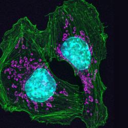 Skin cancer cells from a mouse show how cells attach at contact points