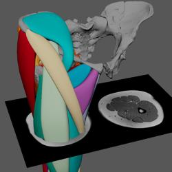 A cross-section of the polygonal muscle modelling approach, guided by muscle scarring and MRI data. 