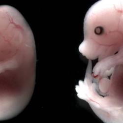 Mouse embryo development