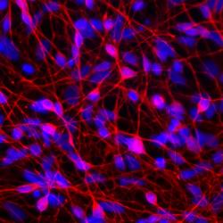 Neurons derived from human embryonic stem cells