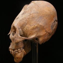 Example of a modified skull, a practice assumed to be Hunnic that may have been appropriated by local farmers within the bounds of the Western Roman Empire.